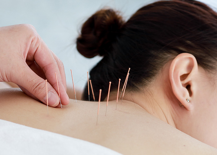 Terapia milenar originária da China