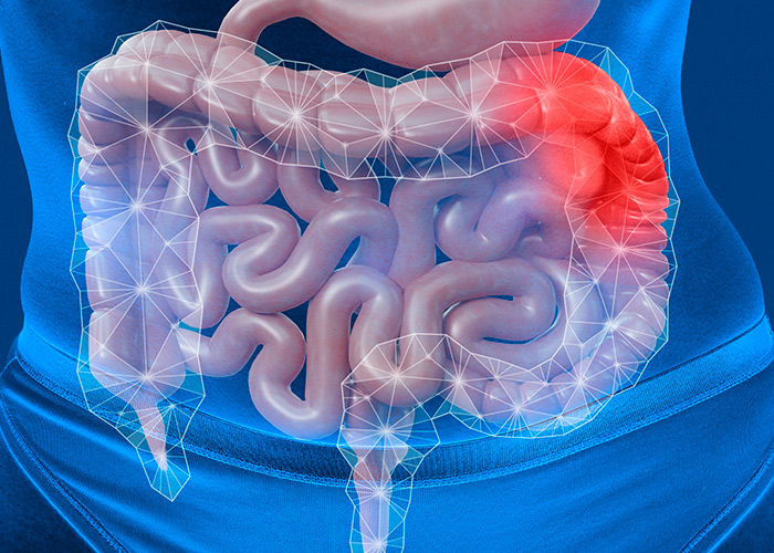 DII tem aumentado no mundo