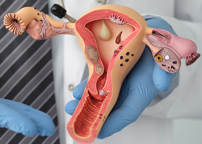 Microambiente do colo do útero e vaginal