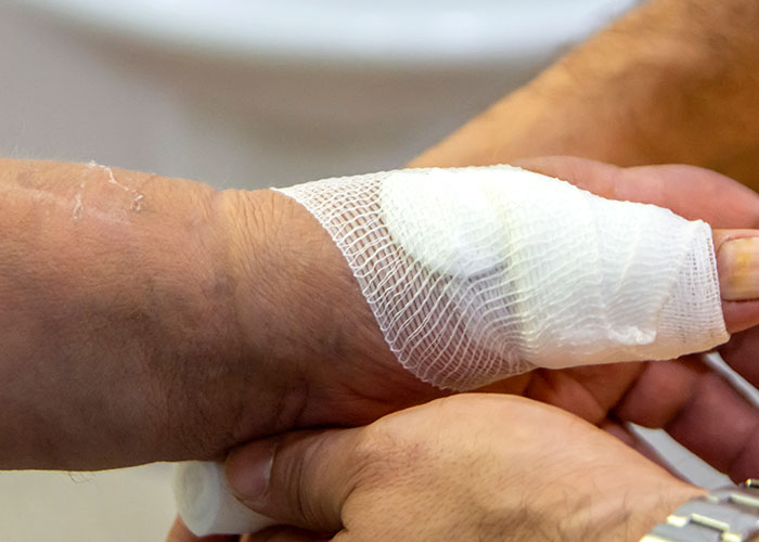 Feridas crônicas são um grave problema