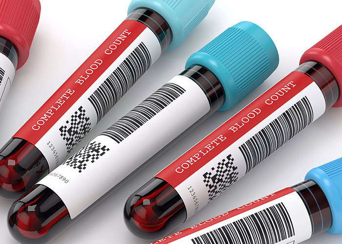 Processamento digital de imagens