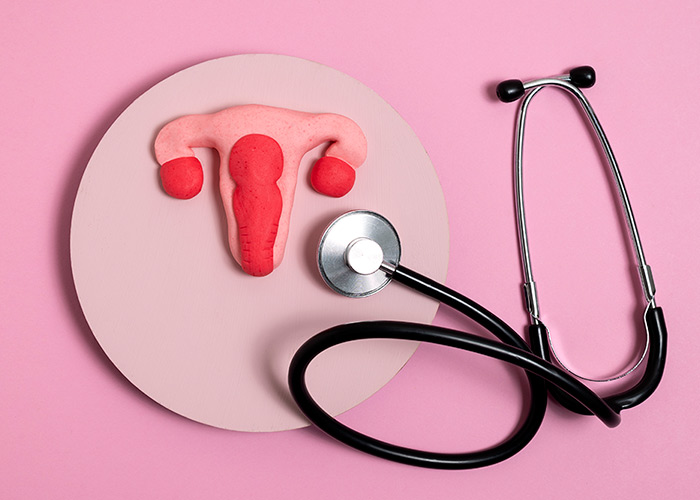 A endometriose é crônica