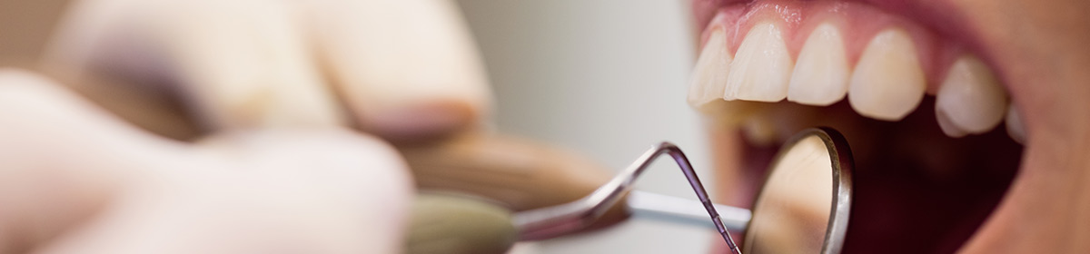 LcS na microbiota da placa dentária