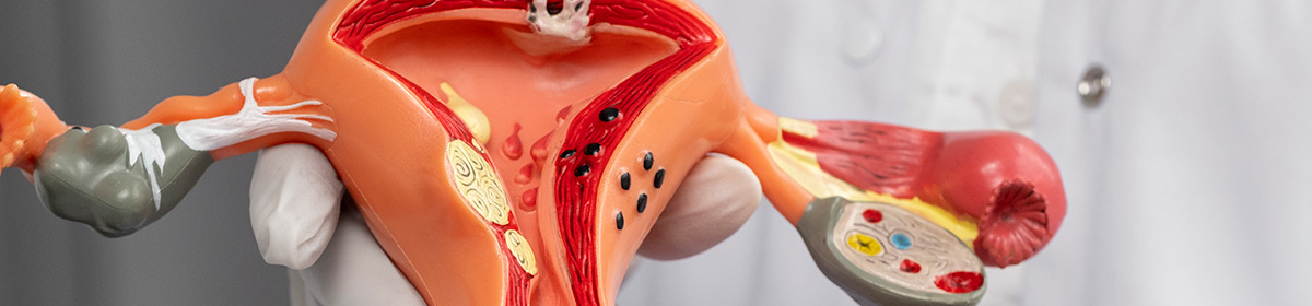 Sustentação da musculatura pélvica