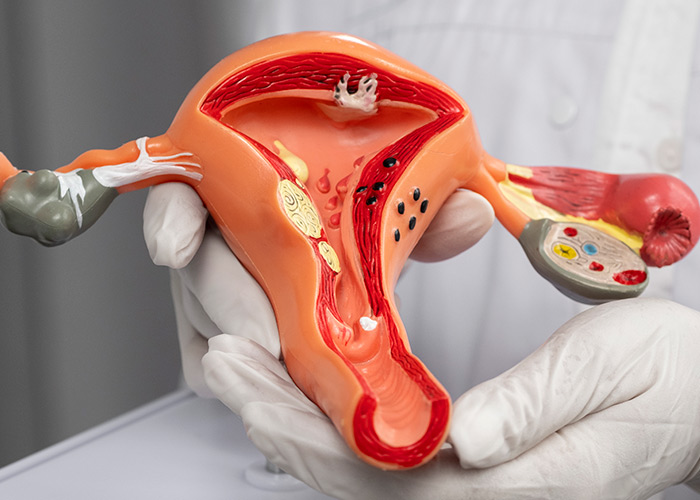 Sustentação da musculatura pélvica