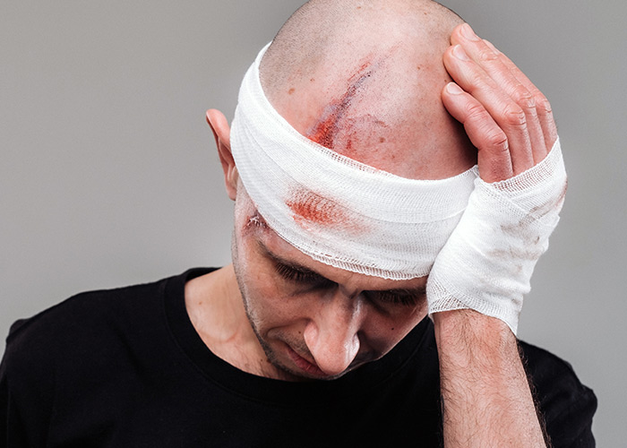 Prevenção de traumas cranianos