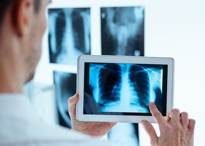 Nanotecnologia e os microrrobôs