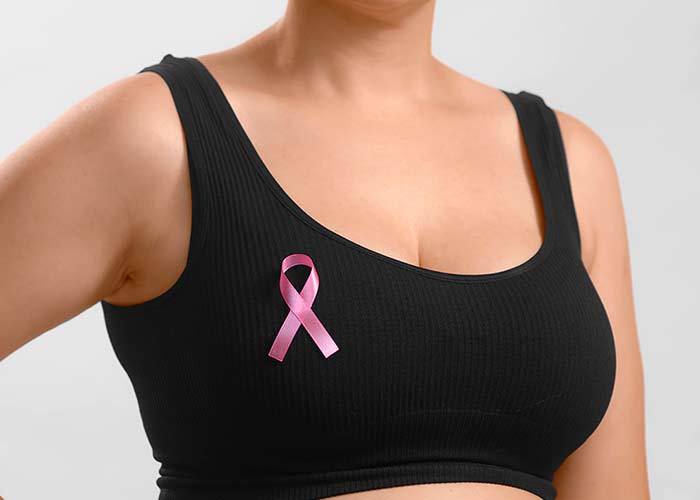 Microbiota intestinal de mulheres com câncer