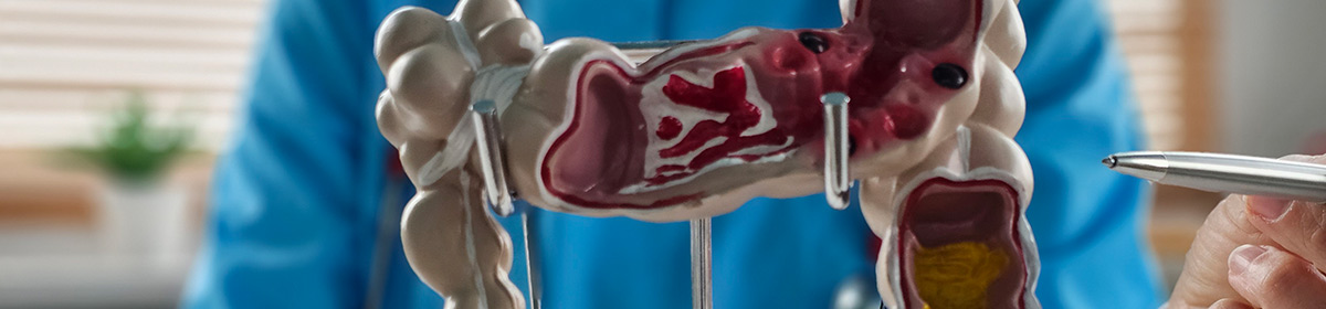 Análise multiômica