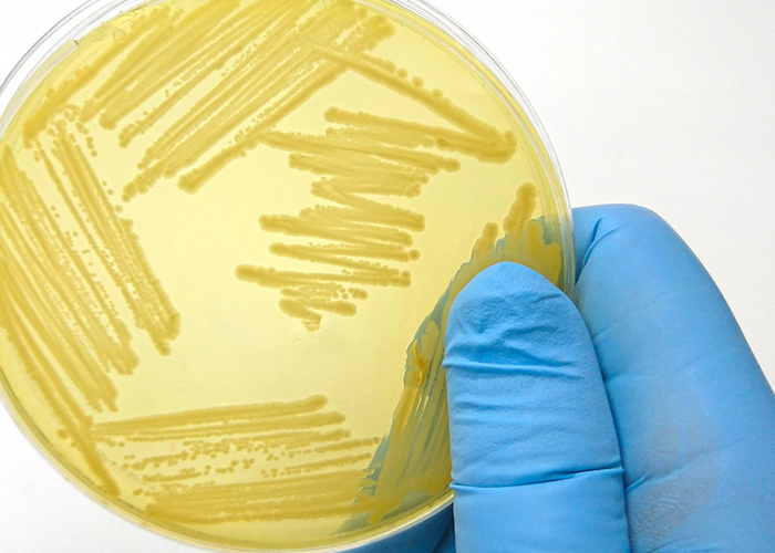 Doença de Parkinson