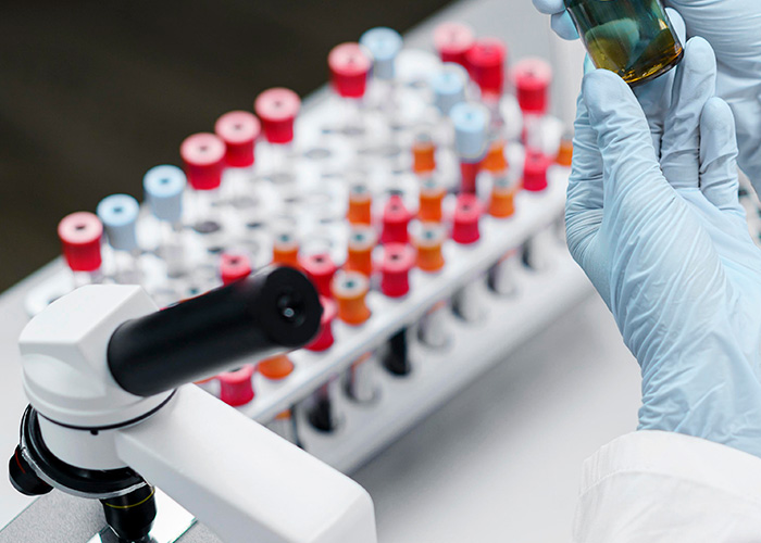 Diagnóstico de cirrose