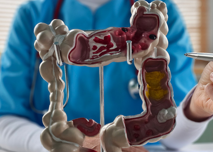 Análise multiômica