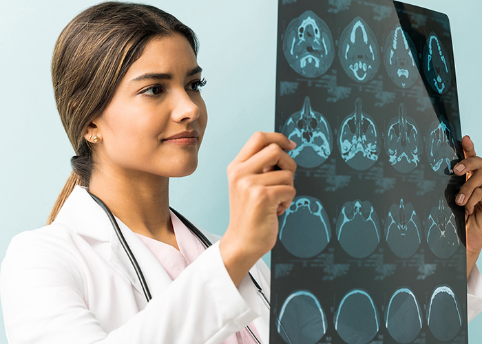 Câncer do sistema nervoso central