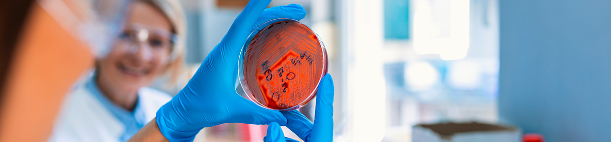 Tumores hematológicos