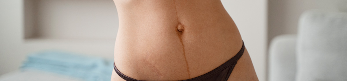 Procedimentos cirúrgicos estéticos