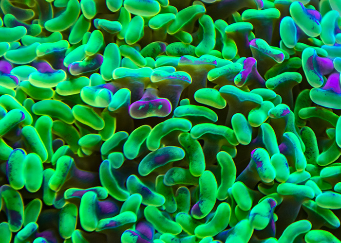 Doença renal crônica