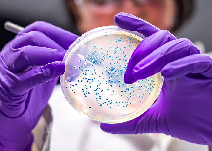 Microbioma geniturinário