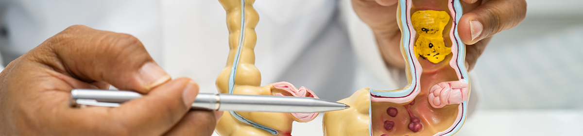 Transplante de microbiota fecal