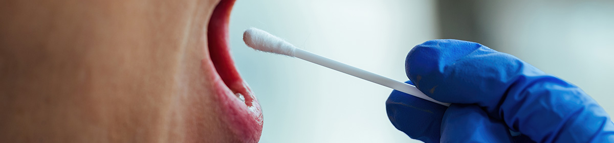 Methanobrevibacter oralis