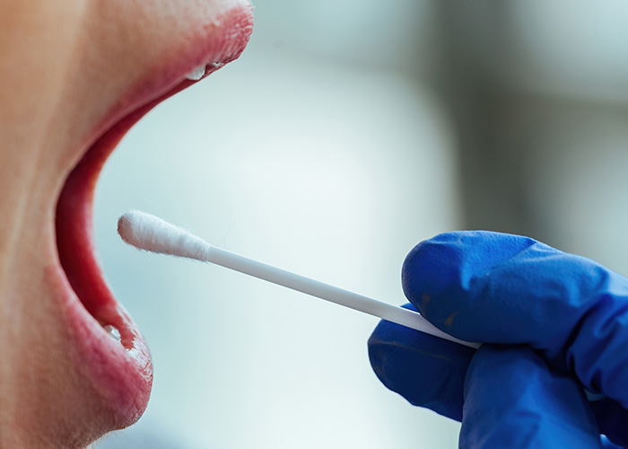 Methanobrevibacter oralis