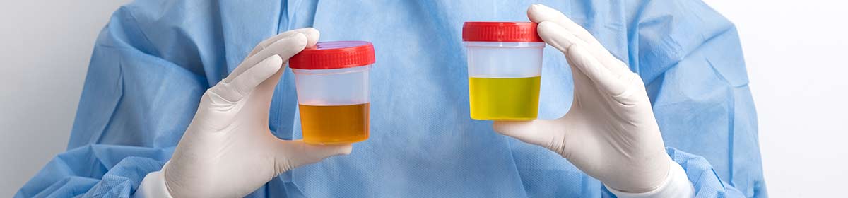 Infecções do trato urinário