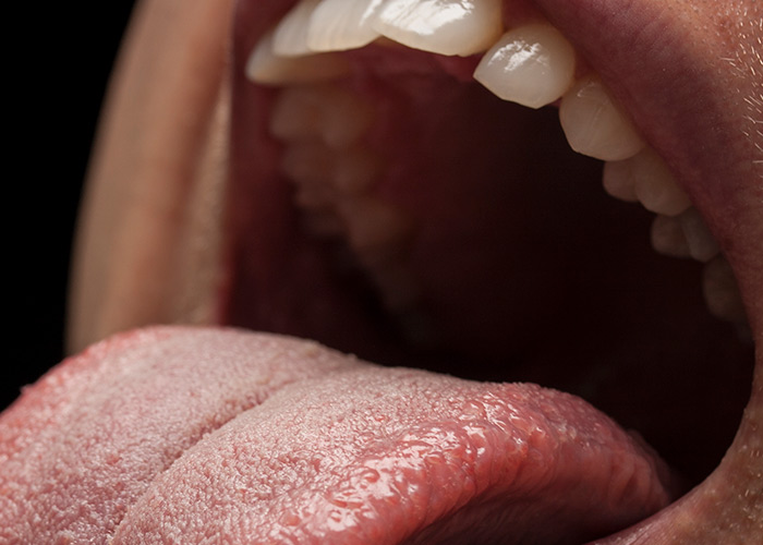 Microbioma oral