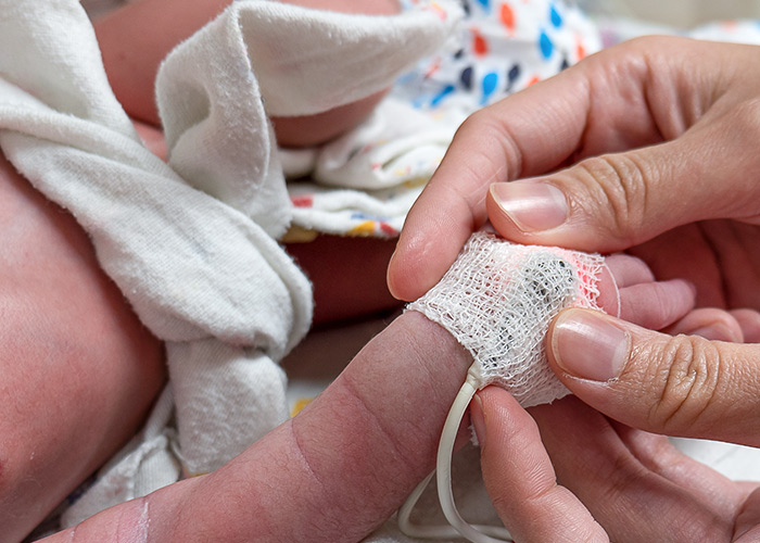 Probióticos como auxiliares para bebês prematuros