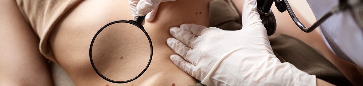 Papel da Dermatologia