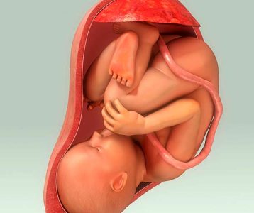 A placenta é uma membrana amniótica