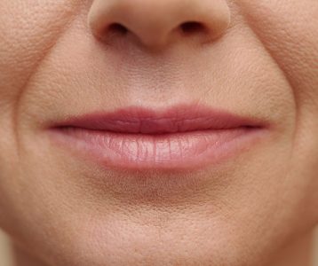 Envelhecimento cutâneo