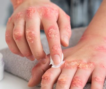 Pele saudável e protegida