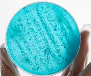 destaque-super-saudavel-edicao-102-microbiota-e-probioticos-transito-colonico destaque-super-saudavel-edicao-102-microbiota-e-probioticos-transito-colonico