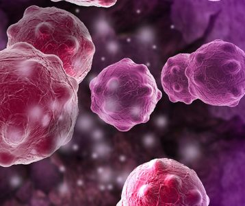 super-saudavel-edicao104-artigo-cientifico-LcS-ajuda-a-controlar-carcinogenese Bebidas probióticas contendo LcS