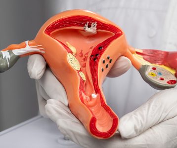 Sustentação da musculatura pélvica