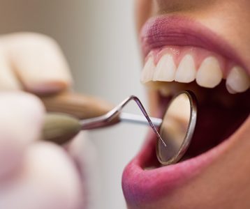 LcS na microbiota da placa dentária