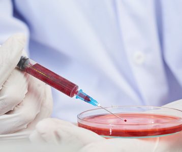 super-saudavel-materia-da-edicao-diagnostico-precoce-pode-salvar-vidas Impacto no sistema imunológico