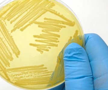 super-saudavel-materia-da-edicao-influencia-de-fungos-no-parkinson Doença de Parkinson
