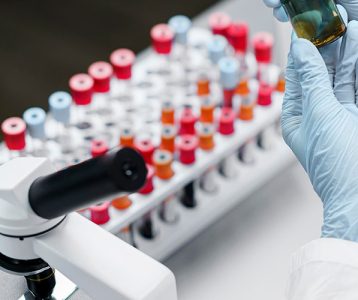 super-saudavel-materia-da-edicao-silenciosa-e-potencialmente-irreversivel Diagnóstico de cirrose