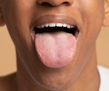 Sistemas de visão computacional