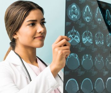 Câncer do sistema nervoso central