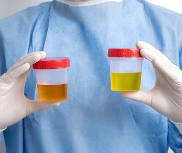 Infecções do trato urinário