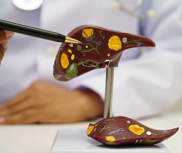 super-saudavel-tecnologia-metodo-melhora-diagnostico-de-doenca-do-figado Biópsia hepática