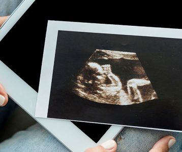 super-saudavel-tecnologia-nova-tecnologia-identifica-sofrimento-fetal Software para identificação de sofrimento fetal