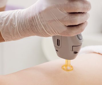 Regeneração dos tecidos