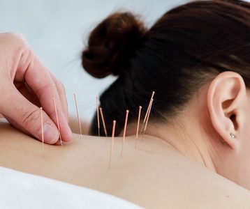 destaque-vida-saudavel-super-saudavel-acupuntura Terapia milenar originária da China